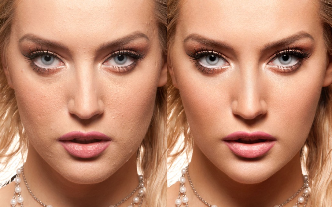 skin-photo-retouching-after-before